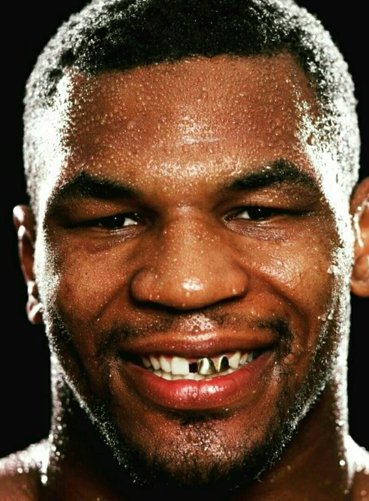 Mike Tyson dental reconstruction